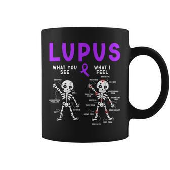 Lupus Awareness Lupus Warrior Lupus Fighter Coffee Mug - Thegiftio UK